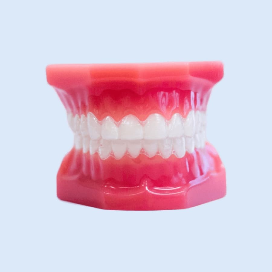 clear invisalign aligners on plastic model