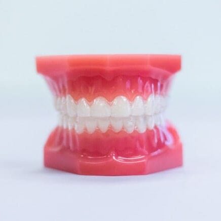 A plastic dental model showing a full set of upper and lower teeth with pink gums, used for dental demonstrations or education. - Raleigh Orthodontics
